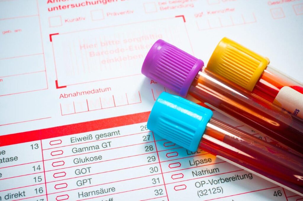 Labordiagnostik vom Heilpraktiker in der Praxis für Naturheilkunde Grüner